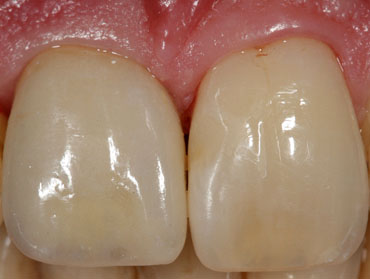 Image of Implant Dentistry